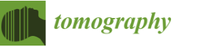Tomography